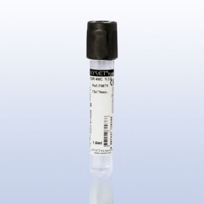 Picture of Blood Collection Tubes for ESR (Erythrocyte Sedimentation Rate)