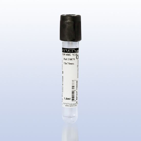 Picture of Blood Collection Tubes for ESR (Erythrocyte Sedimentation Rate)